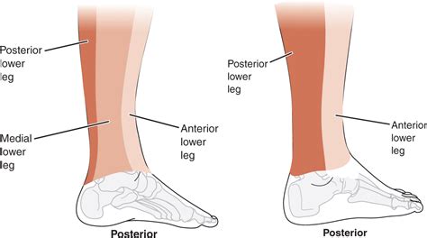 [DIAGRAM] Diagram Of Leg Pain - MYDIAGRAM.ONLINE