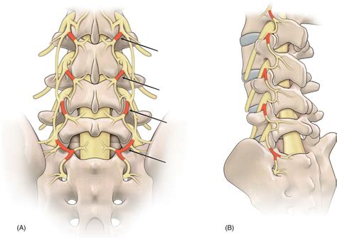 Radiofrequency Neurolysis | Anesthesia Key