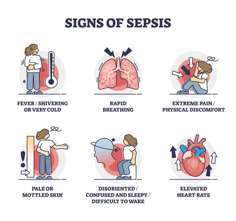 Sepsis Things To Know About Blood Poisoning | The Best Porn Website