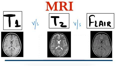 T1 MRI vs T2 MRI vs FLAIR MRI || MRI Brain || Radiology - YouTube