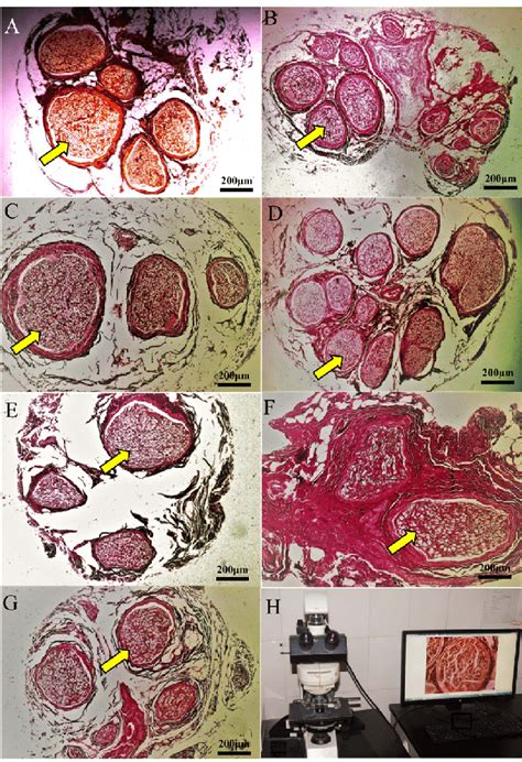 Histology of axons in the nerves after silver impregnation under ...