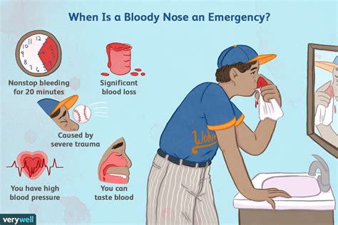 How To Stop Nose Bleeding