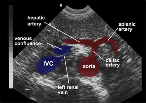 Pin by 안종진 on Ultrasound | Medical ultrasound, Diagnostic medical ...