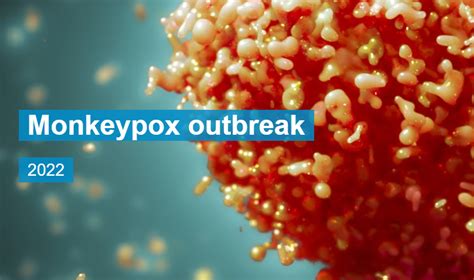 Monkeypox Outbreak 2022 – UW Health Sciences Library