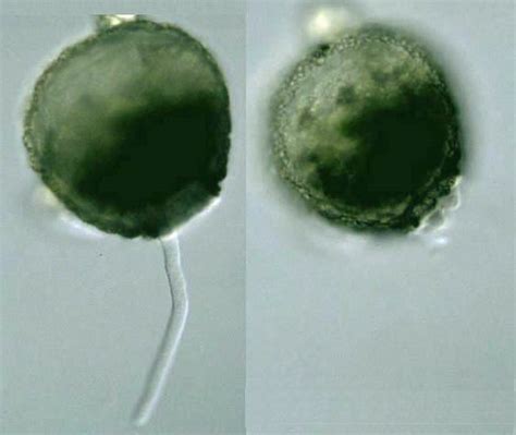 Protist Images: Difflugia