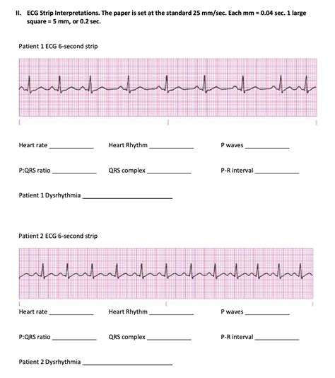 Solved ECG Interpretation رسیلیبریدہ س الم مراسم 1. 2. 3. | Chegg.com