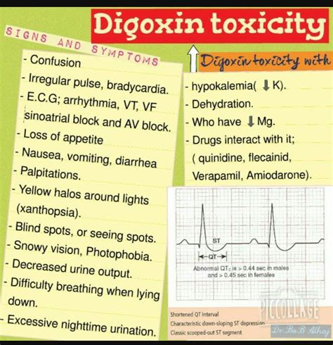 Digitalis toxicity | Nursing school tips, Nursing school survival ...