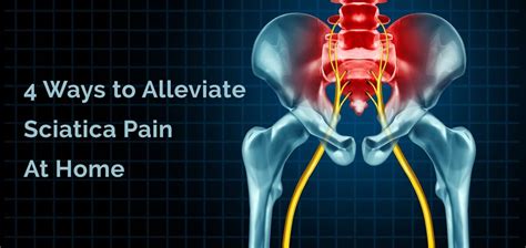 4 Ways to Alleviate the Pain of Sciatica and Protect Your Back and ...