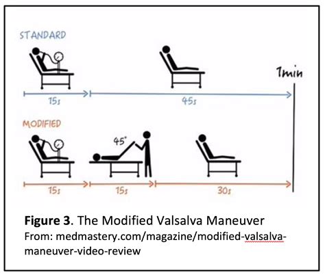 emDOCs.net – Emergency Medicine EducationTreatment of Refractory SVT ...