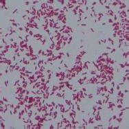 Gram negative, pink colored, small rod shape E. coli under light ...