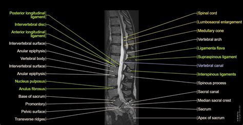 Anatomy of the lumbar vertebrae: normal anatomy | e-Anatomy