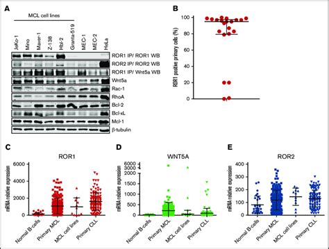 Expression levels of Wnt5a-, ROR1-, and ROR2-signaling pathways in MCL ...