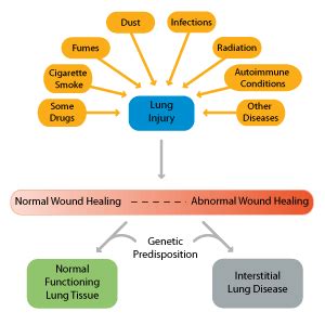 Familial Pulmonary Fibrosis: Causes of Pulmonary Fibrosis