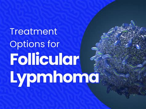 What Are the Treatment Options For Follicular Lymphoma? | Massive Bio