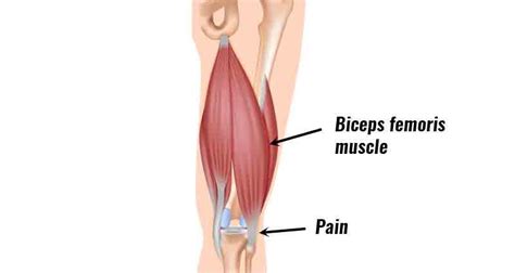 [DIAGRAM] Rectus Femoris Diagram - MYDIAGRAM.ONLINE