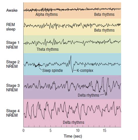 Diagram of Electroencephalogram (EEG) techniques measuring sleep ...