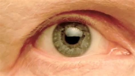 My Right Pupil Exhibiting: Hippus / Pupillary Athetosis - YouTube