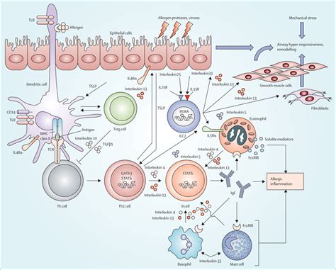 Asthma - The Lancet