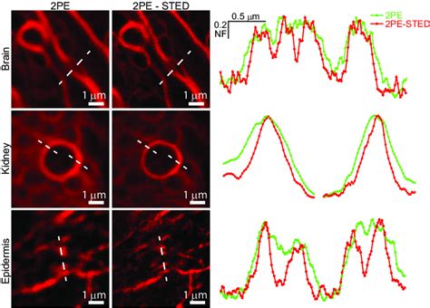 Resolution improvement due to 2PE-STED microscopy of fine structures in ...