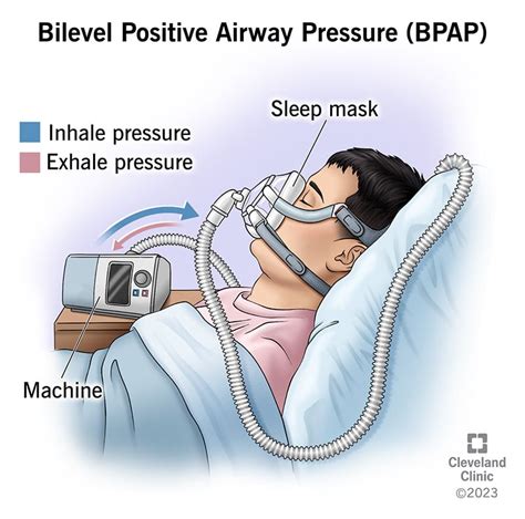 BiPAP Machine: Uses, Benefits, Side Effects & Alternatives