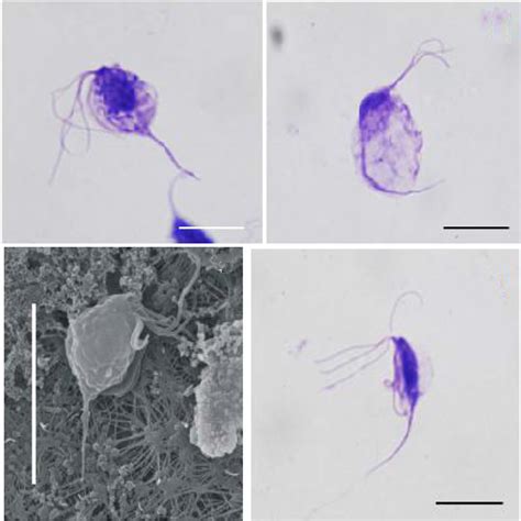 Trichomonas gypaetinii | Microorganismos