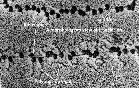 Ribosomes Electron Micrograph