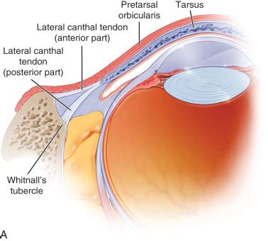 The Spectrum of Canthal Suspension Techniques in Lower Blepharoplasty ...