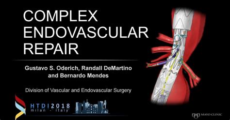 Complex endovascular repair – Vascupedia