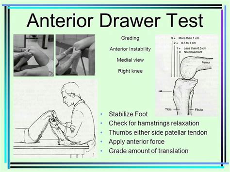 Anterior drawer test for ACL injury... | Physical therapy school ...