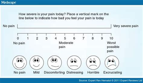 Printable Pain Scale Chart