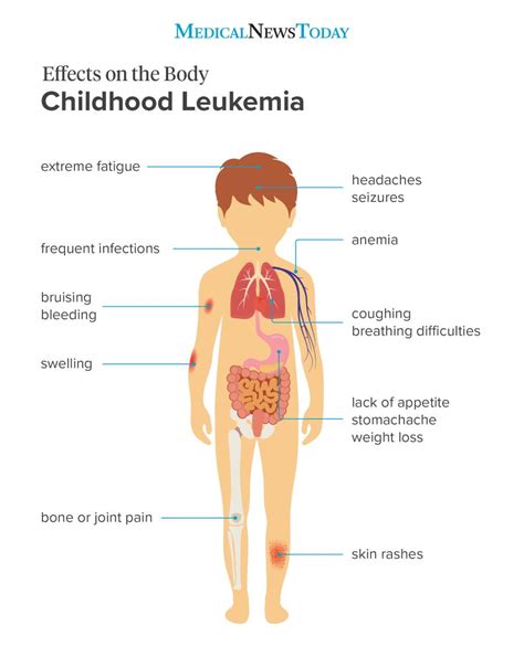 11 symptoms of leukemia in children