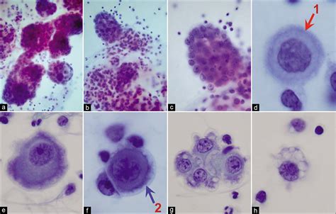 The panorama of different faces of mesothelial cells - CytoJournal