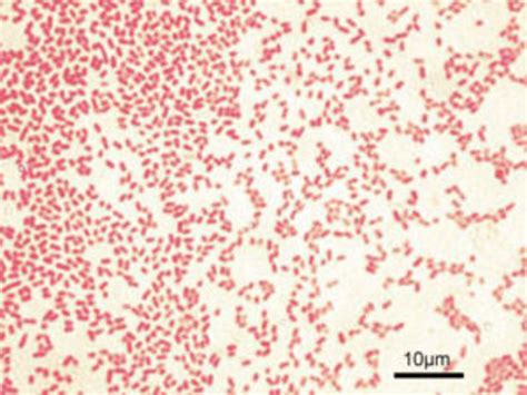 Gram Staining: Gram positive and Gram negative bacteria | hubpages