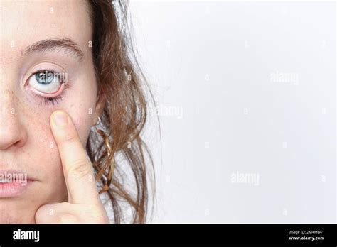 Half face of woman with finger lowering the eyelid for an eye ...