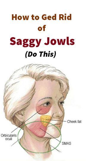 Jowls develop due to loss of subcutaneous fat... Fast Weight Loss Diet ...