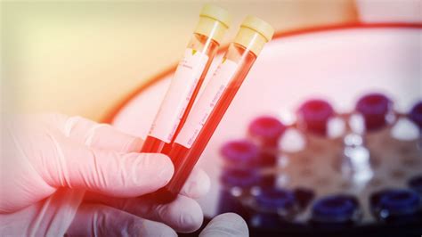 Daewoong Pharmaceutical Reveals Bersiporocin's Antifibrotic Mechanism