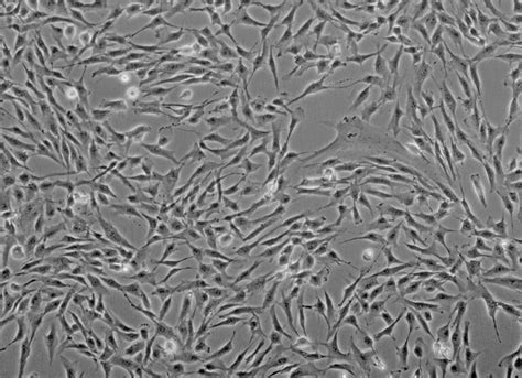 Dermal Fibroblast Cells: Biology and Function in Skin Regeneration ...