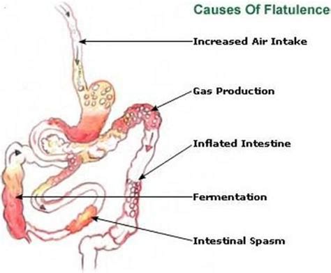 The Complete Guide To Stop Farting Fast Using Natural Remedies ...