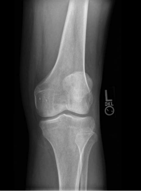 Awesome What Are The 3 Views Of A Knee X Ray Current Issues In Accounting