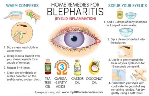 Blepharitis - IMU computer group 6 Treat the disease not the symptom