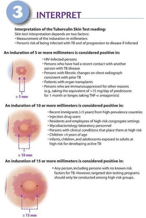 TB Mantoux test (PPD... - Healthmax Medical and Diagnostic