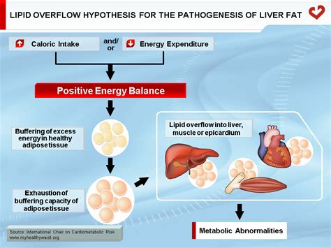 Liver Fat - My Healthy Waist