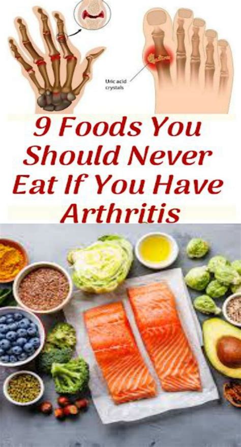 9 Foods You Should Never Eat If You Have Arthritis | Food, Healthy ...