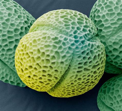 Pollen Grains Under Microscope | Amusing Planet