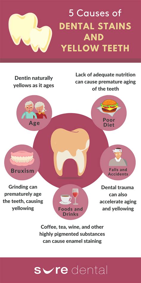 What Really Causes Dental Stains and Yellow Teeth? (INFOGRAPHIC) - Sure ...