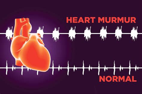 Heart Murmur: Silent Signs You Need to Know | The Healthy