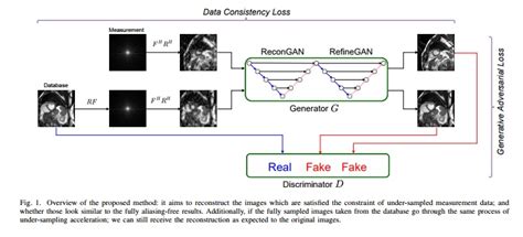 Nuit Blanche: Compressed Sensing MRI Reconstruction with Cyclic Loss in ...