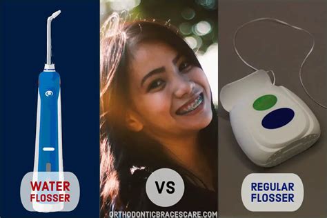 Can I Use Waterpik Instead Of Flossing With Braces? - Orthodontic ...