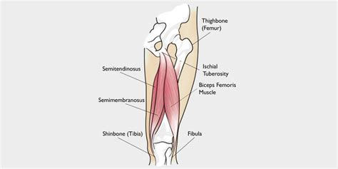 Hamstring Tendonitis - The Complete Injury Guide - Vive Health