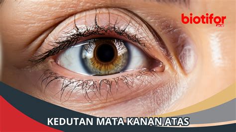 Kedutan Mata Kanan Atas: Mitos dan Fakta - Biotifor